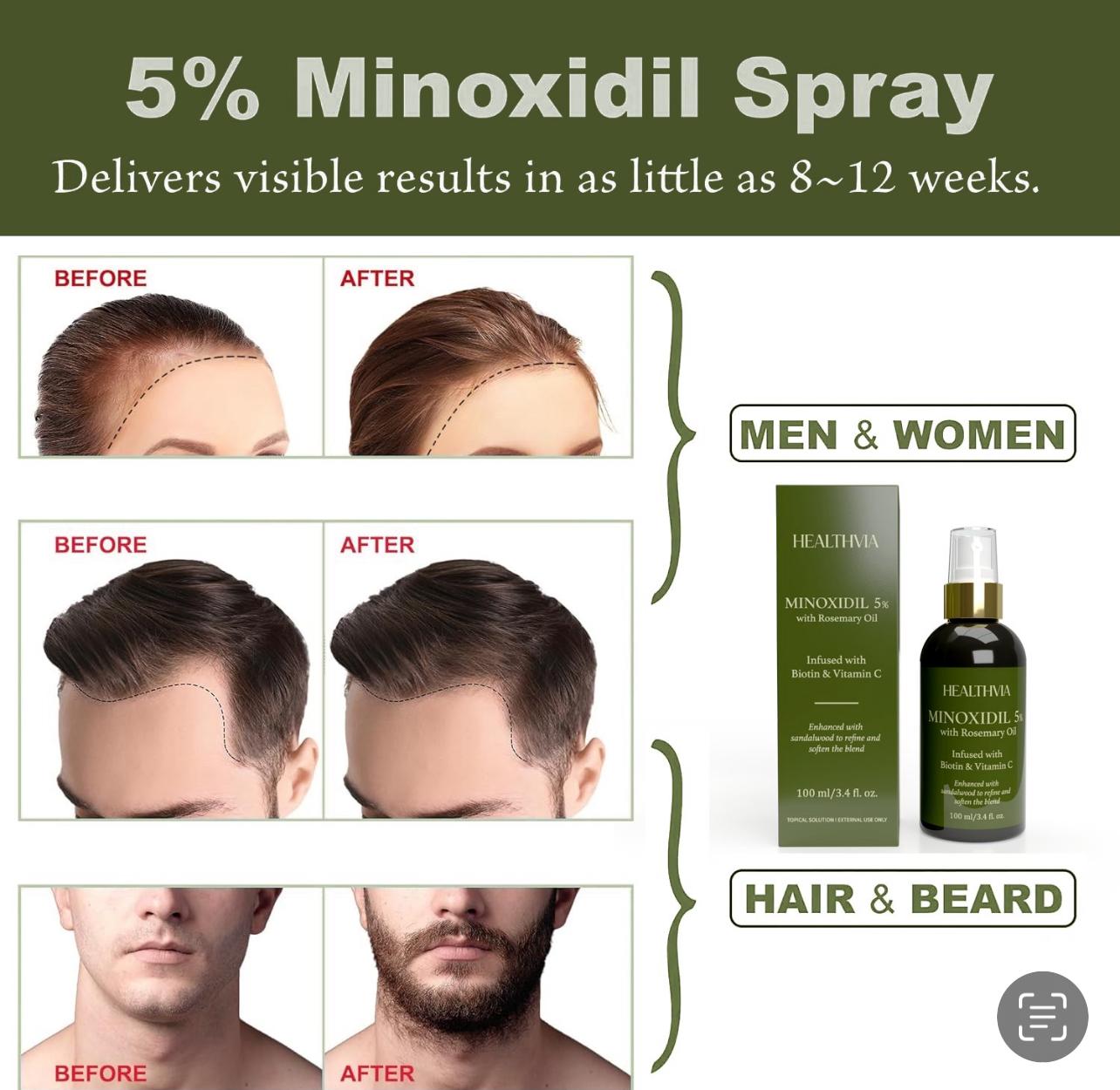 Minoxidil 5% Hair & Beard Growth Spray for Men & Women with Rosemary Oil, Biotin & Vitamin C – Fresh Sandalwood Scent, 100ml